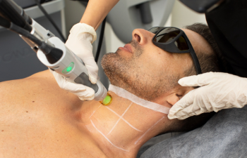 Laser Hair Removal And Why It's Becoming So Desired