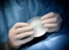 The Breast Implant Revolution: A Look into Smart Implants and Their Cutting-Edge Technology